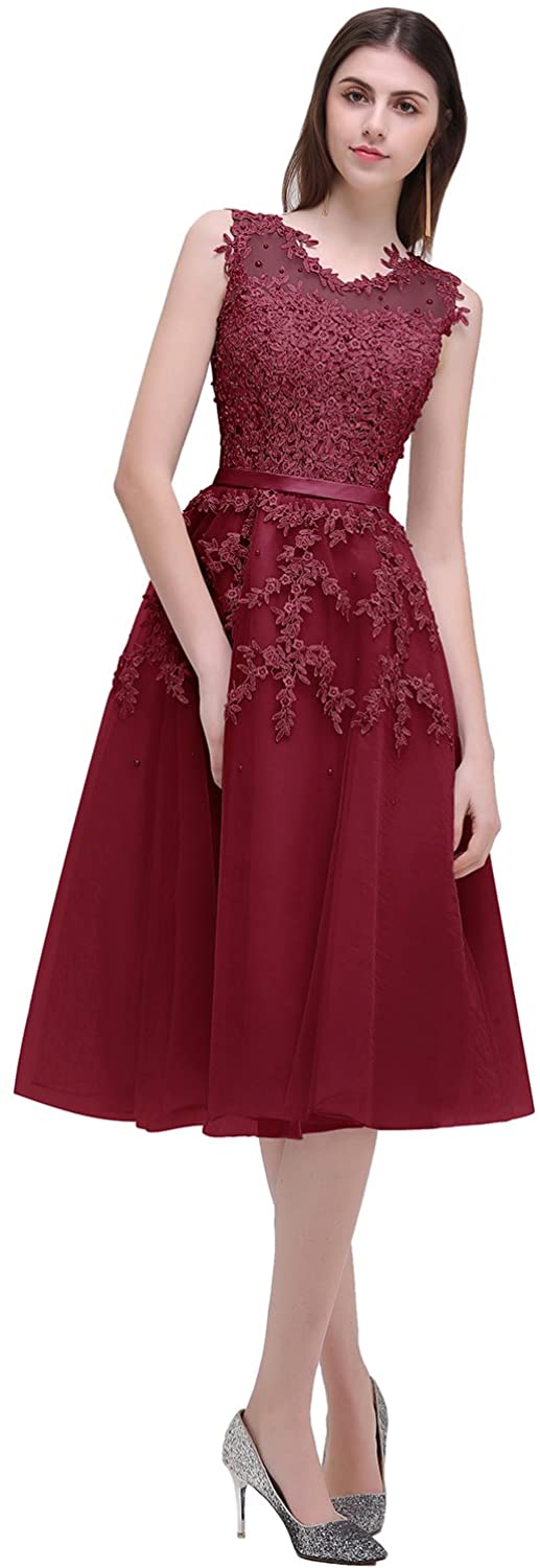 Price:$48.99 MisShow Women's Lace Appliques Tulle Short Evening Cocktail Gowns 2018 at Amazon Women’s Clothing store