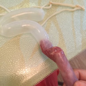 The practice measure of bowel of children of the Taiwan bowel that bake 5